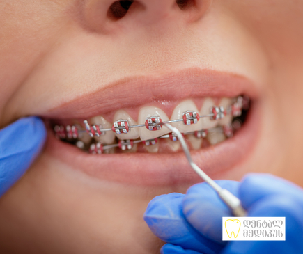 Slider image (5) Dental Medicus